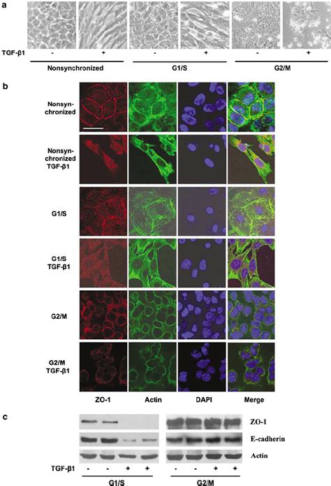 Tgf B 1 Induced Emt Was Dependent On The Cell Cycle State