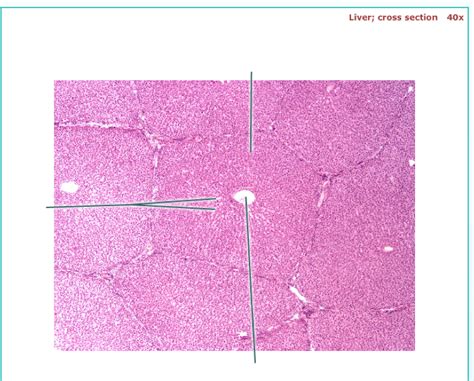 Liver Histology Diagram Hot Sex Picture