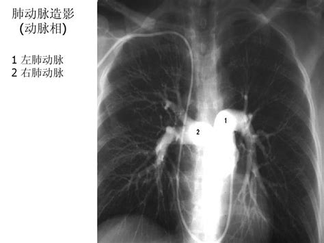 胸部x 线图解word文档在线阅读与下载无忧文档