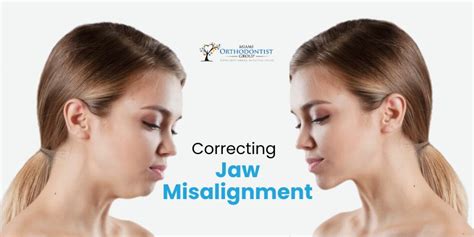 Correcting Jaw Misalignment A Comprehensive Guide To Orthognathic Surgery