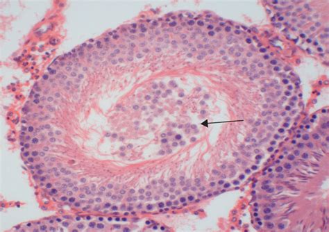 Histopathological Features Of Testicular Tissue In The Control