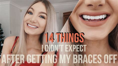 How Long Does It Take Your Mouth To Get Used To Braces At