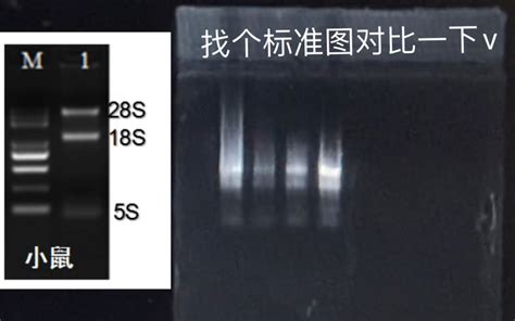 实验操作 9小鼠肝脏总rna提取与逆转录 小lu浮生记 小lu浮生记 哔哩哔哩视频