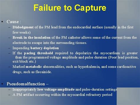 Pacemaker Malfunction Ecg Signs Of Pacemaker Malfunction Failure