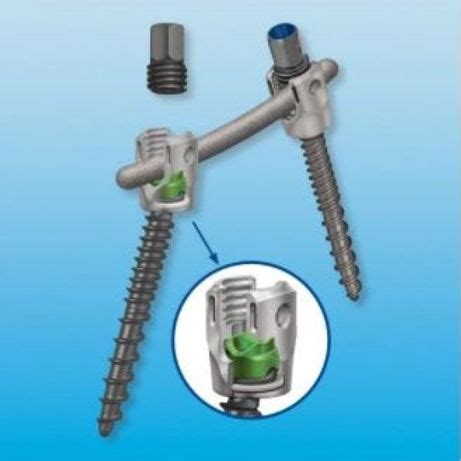 Medtronic Sofamor Danek CD HORIZON SOLERA VOYAGER Pedicle Screw Syst