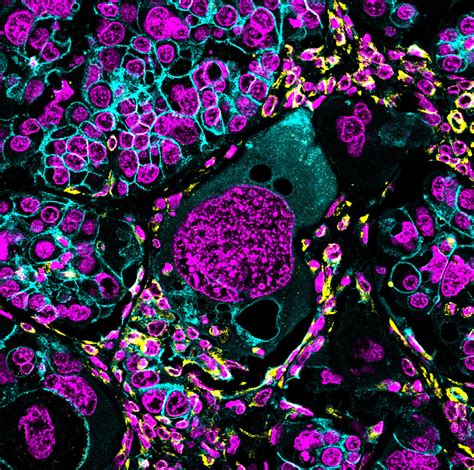 Stress Responders: Giant Polyploid Cells - 3 Quarks Daily 