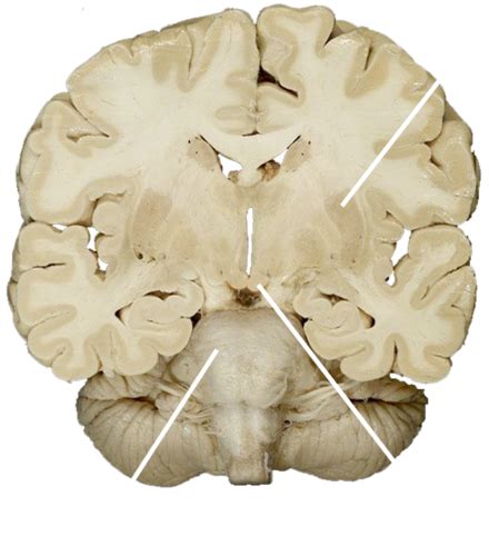 Brain Stem And Cerebellum Flashcards Quizlet