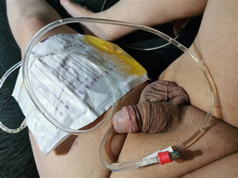 My Catheter Nude Pics Xhamster