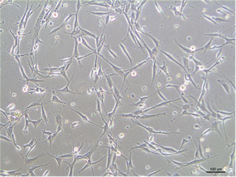 Transplantation Of Bmp Gene Transfected Bone Marrow Mesenchymal Stem