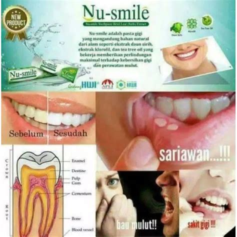 Jual Nu Smile Odol Herbal Ampuh Sembuhkan Sakit Gigi Sariawan Bau Mulut