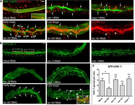 Effects of early secretory pathway perturbation on post-Golgi vesicle... | Download Scientific ...