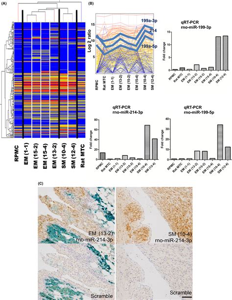 Overexpression Of MiR199 214 Is A Distinctive Feature Of Ironinduced