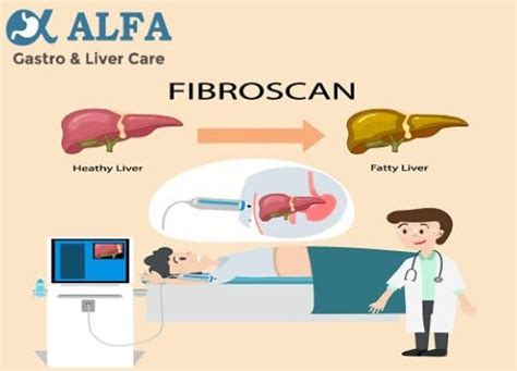 Understanding The Fibroscan Test A Non Invasive Assessment Of Liver Health Dr Vatsal Mehta