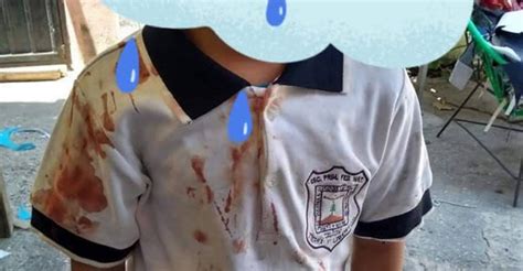 Con Playera Escolar Ensangrentada Madre Denuncia Bullying Contra Su