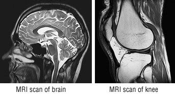 Magnetic Resonance Imaging MRI Harvard Health