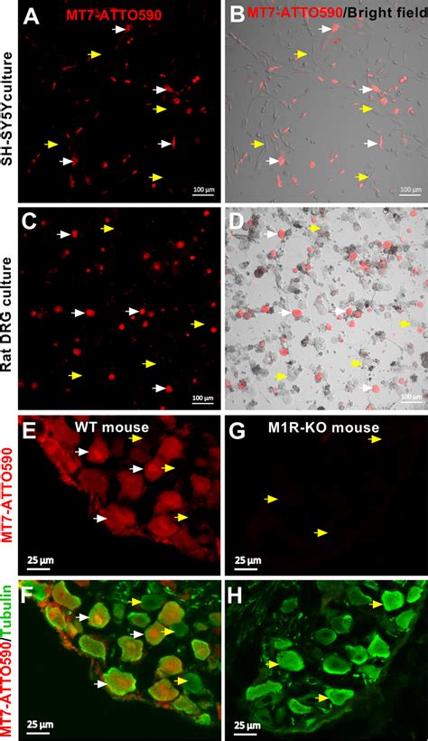 Human neuroblastoma SH-SY5Y cell line and DRG neurons express M1 ...