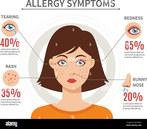 Allergy Symptoms Flat Style Concept With Tearing Rash Redness And Runny