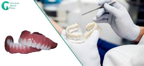 Same Day Dentures Vs Traditional Dentures Which Is Better