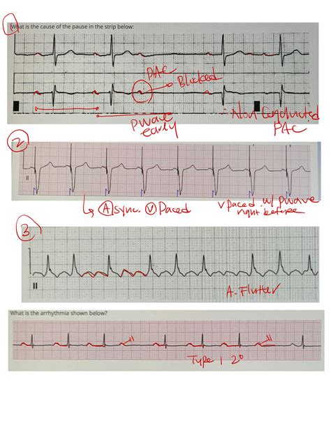 Solution Ekg Final Studypool