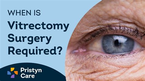 What Is Vitrectomy Surgery Pristyn Care Youtube