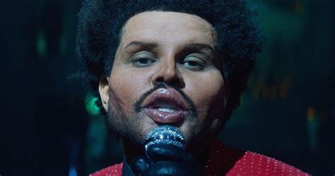 Did The Weeknd Get Plastic Surgery?