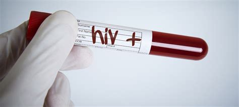 Treating Precancerous Growths Cuts Risk Of Anal Cancer In People With