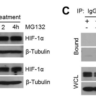 TQ suppresses HIF 1α via the proteasome dependent degradation pathway