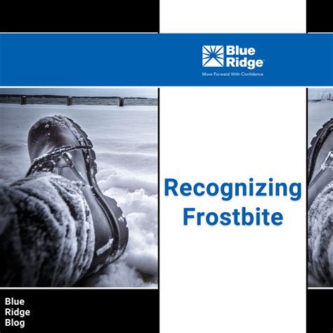 Recognizing Frostbite | Blue Ridge Risk Partners