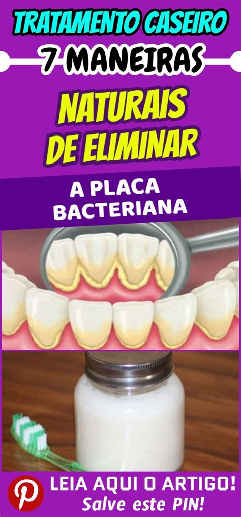 Maneiras Naturais De Eliminar A Placa Bacteriana As Escova Es