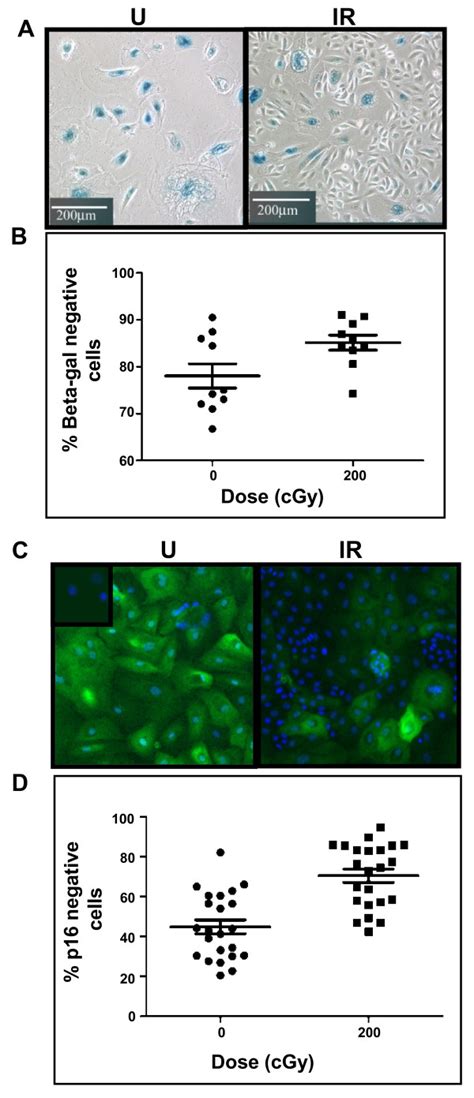 Cultures Derived From Irradiated Human Mammary Epithelial Cells Show