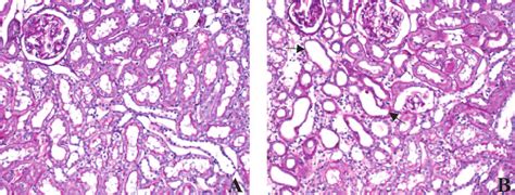 Representative Figures Of Histology From Experiment II Unilateral