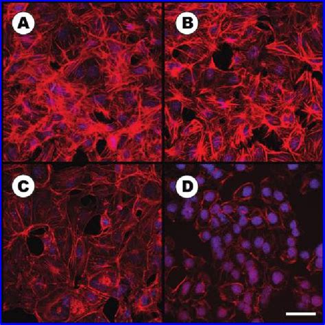 Figure From Investigating Cytoskeletal Alterations As A Potential