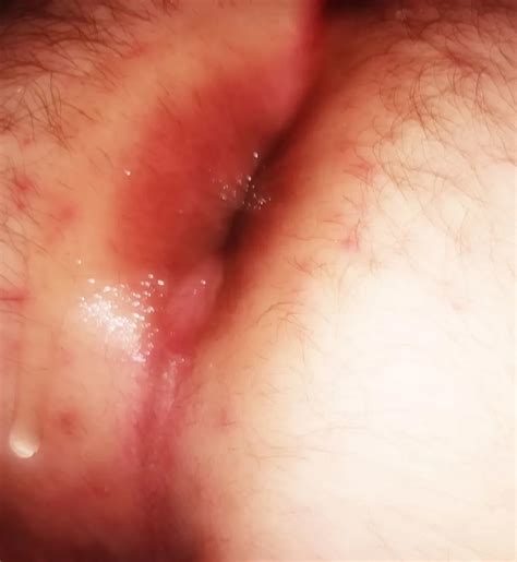 I M In Bondage Can You Please Fuck Me 11 Nude Pics XHamster