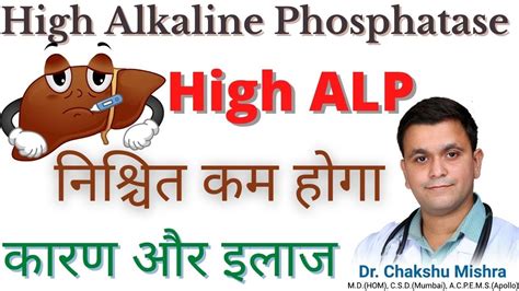 High Alkaline Phosphatase ALP In LFT Causes Treatment Liver Kharab