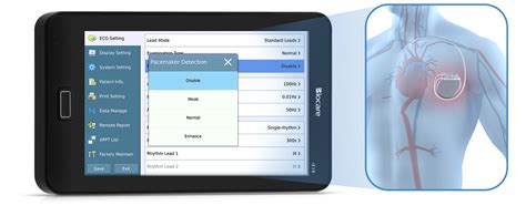 Point Of Care 12 Lead Ecg Ekg Machine Based On A Tablet With Auto