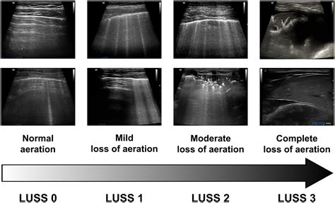 pleural effusion dog ultrasound