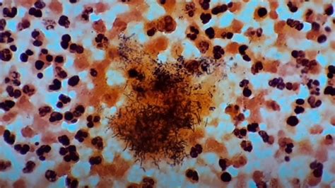 Actinomyces Introduction Classification Morphology Pathogenecity Lab