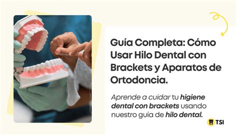 Hilo Dental Con Ortodoncia Importancia Y Recomendaciones