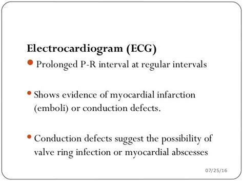 Infective Endocarditis