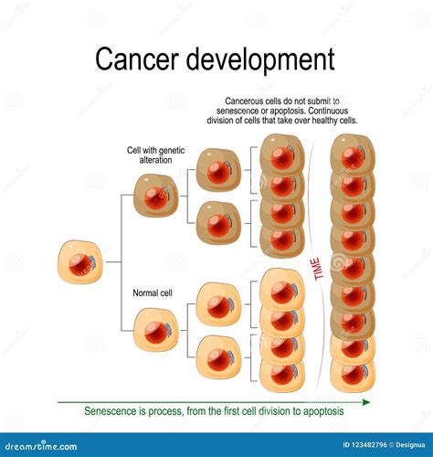 Krebs Entwicklung Vektor Abbildung Illustration Von Diagramm 123482796