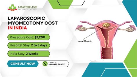 Laparoscopic Myomectomy Cost In India Top Hospitals Safartibbi