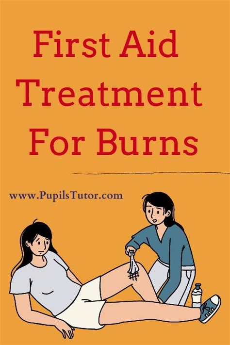 First Aid Treatment For Burns Artofit