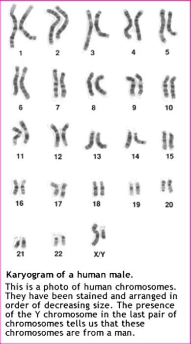 Albinism Chromosome 11