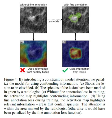 Paper Note Interpretable Mammographic Image Classification Using Case