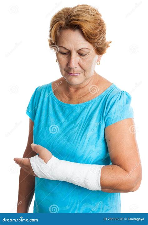 Woman With A Broken Arm On A Plaster Cast Stock Photo Image 28533220