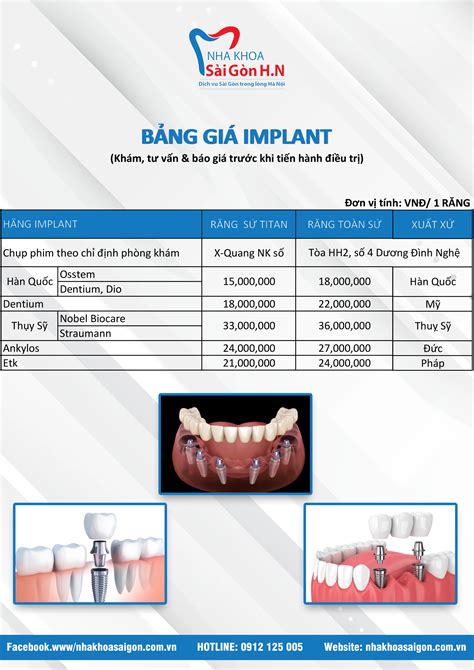 Bảng giá trồng răng Implant