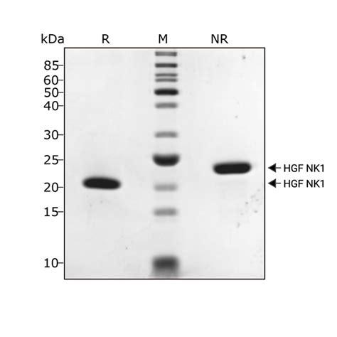 Recombinant Human HGF Protein Qk013 Qkine