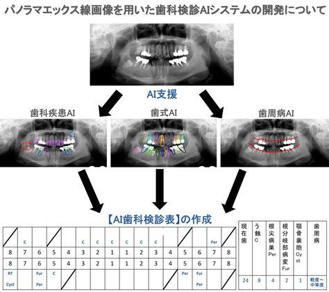 歯科エックス線画像を用いた歯科検診aiシステムの開発 医療法人社団 葵会 Aoi国際病院のプレスリリース