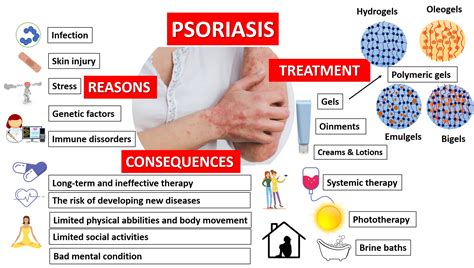 Psoriasis Treatment Options