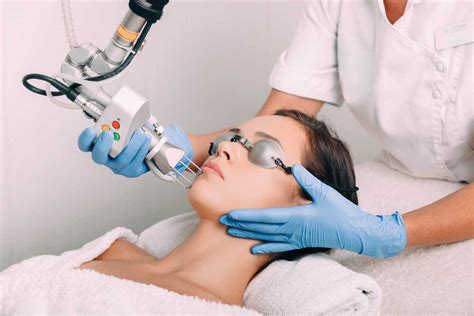 Trị Sẹo Rỗ bằng Laser CO2 Fractional Công nghệ An toàn Hiệu quả